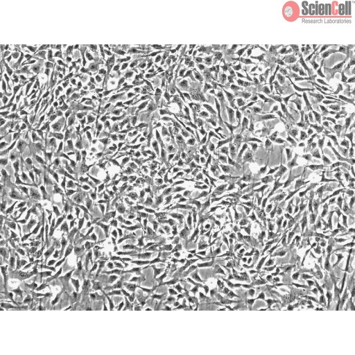 Human Chondrocytes Cells