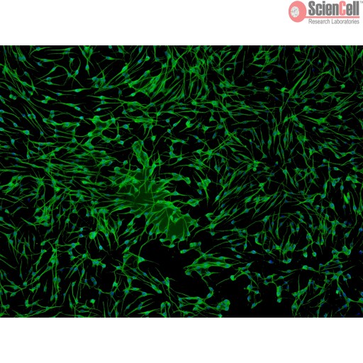 Human Melanocytes Cell_HEM-I