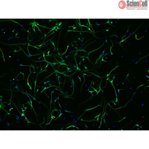 Human Neurons Cell_HN