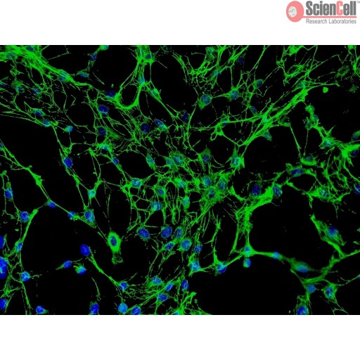 Human Osteoblasts Cell_HO-f